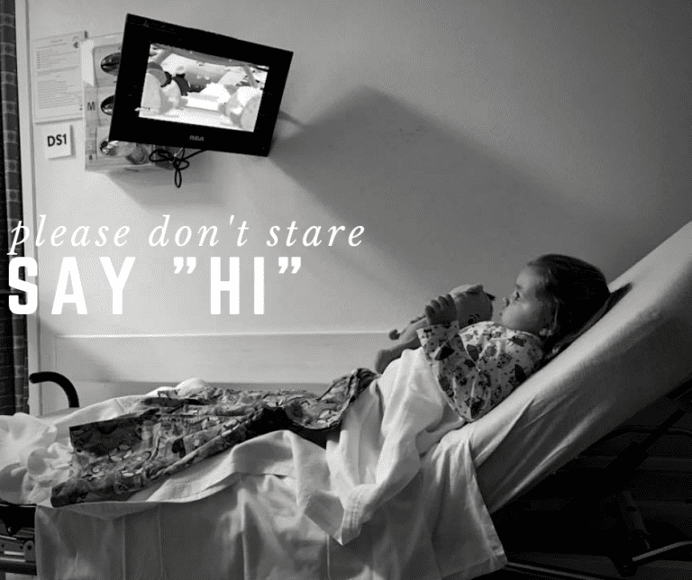 Please Don’t Stare, Just Say “Hi” | Living With Scoliosis